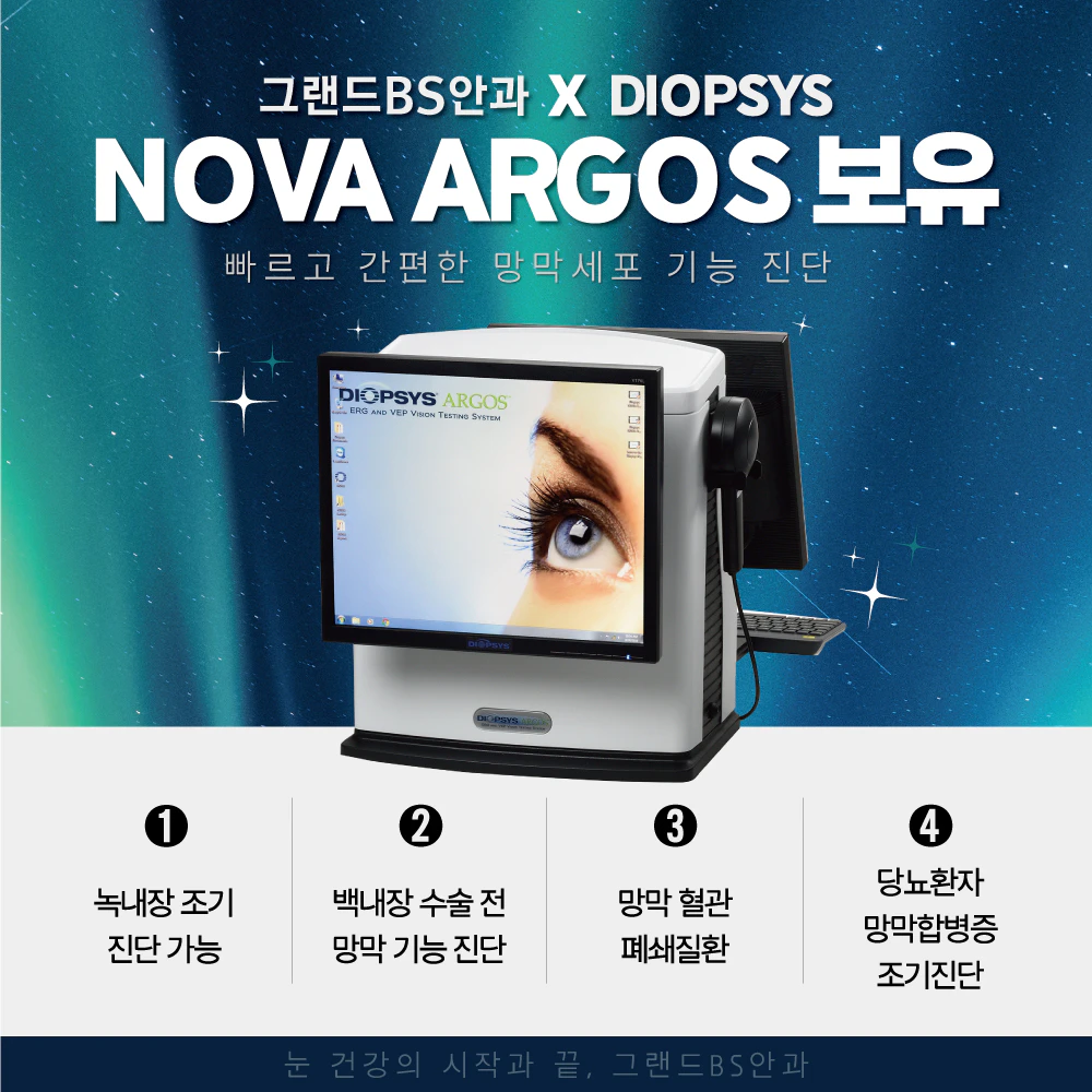 DIOPSYS NOVA ARGOS 보유