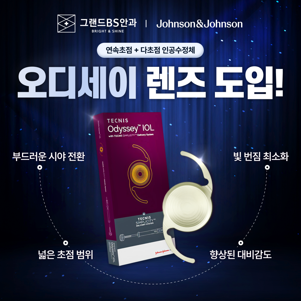 오디세이 렌즈 도입